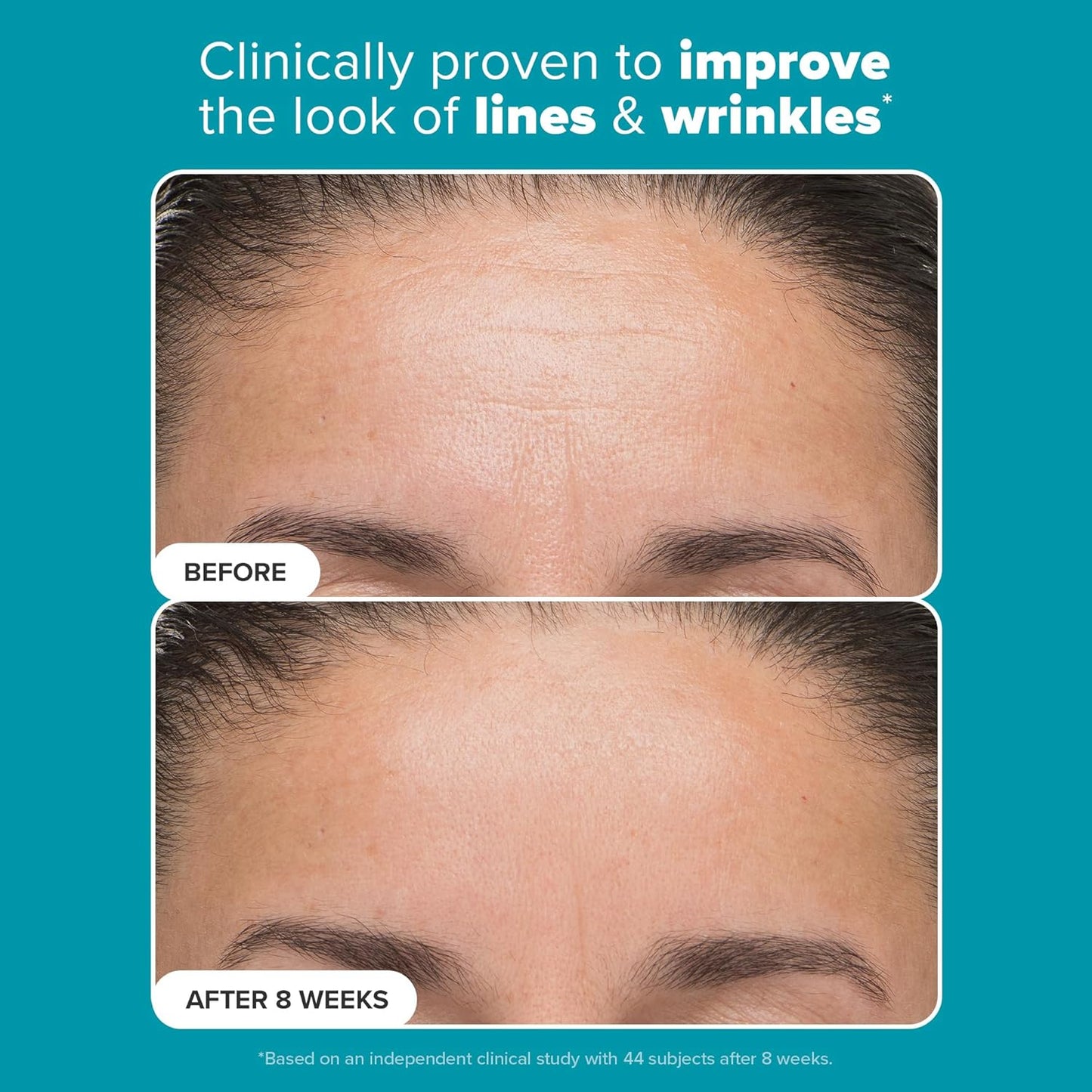 Paula's Choice - 6% Mandelic Acid + 2% Lactic Acid Exfoliant 30ml