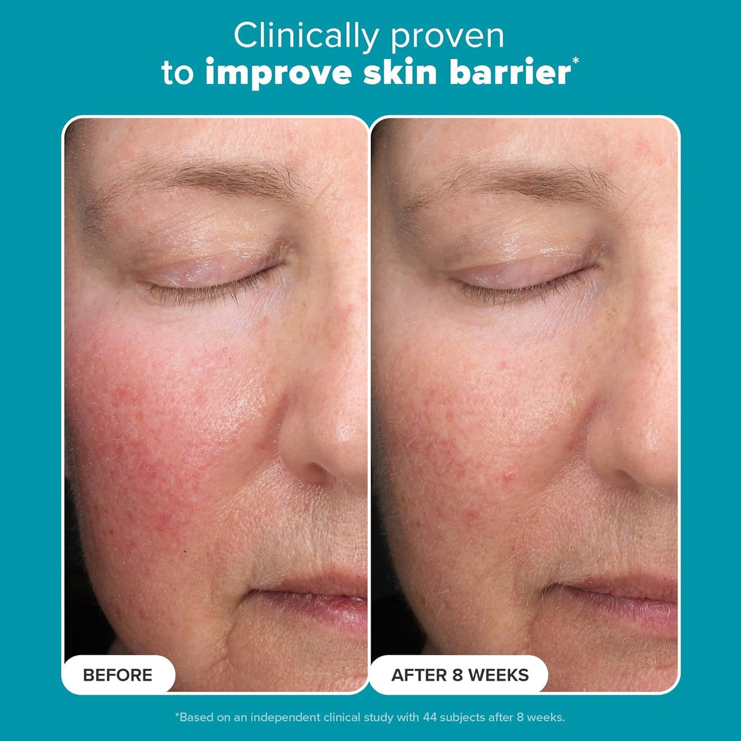 Paula's Choice - 6% Mandelic Acid + 2% Lactic Acid Exfoliant 30ml