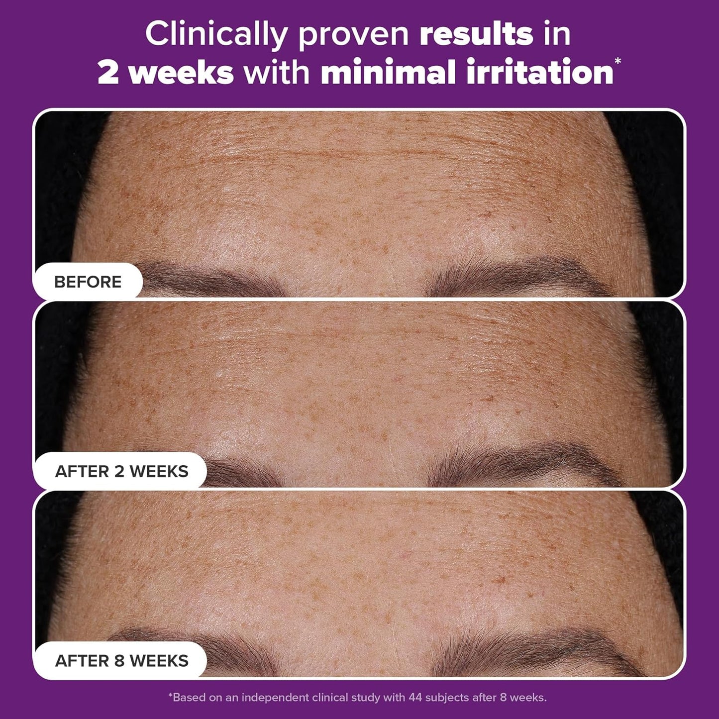 Paula's Choice - PRO Retinaldehyde Dual-Retinoid Treat 30ml