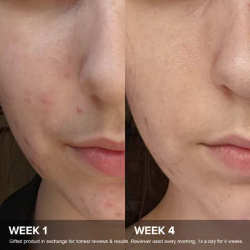 Paula's choice - C15 Super Booster 20ml